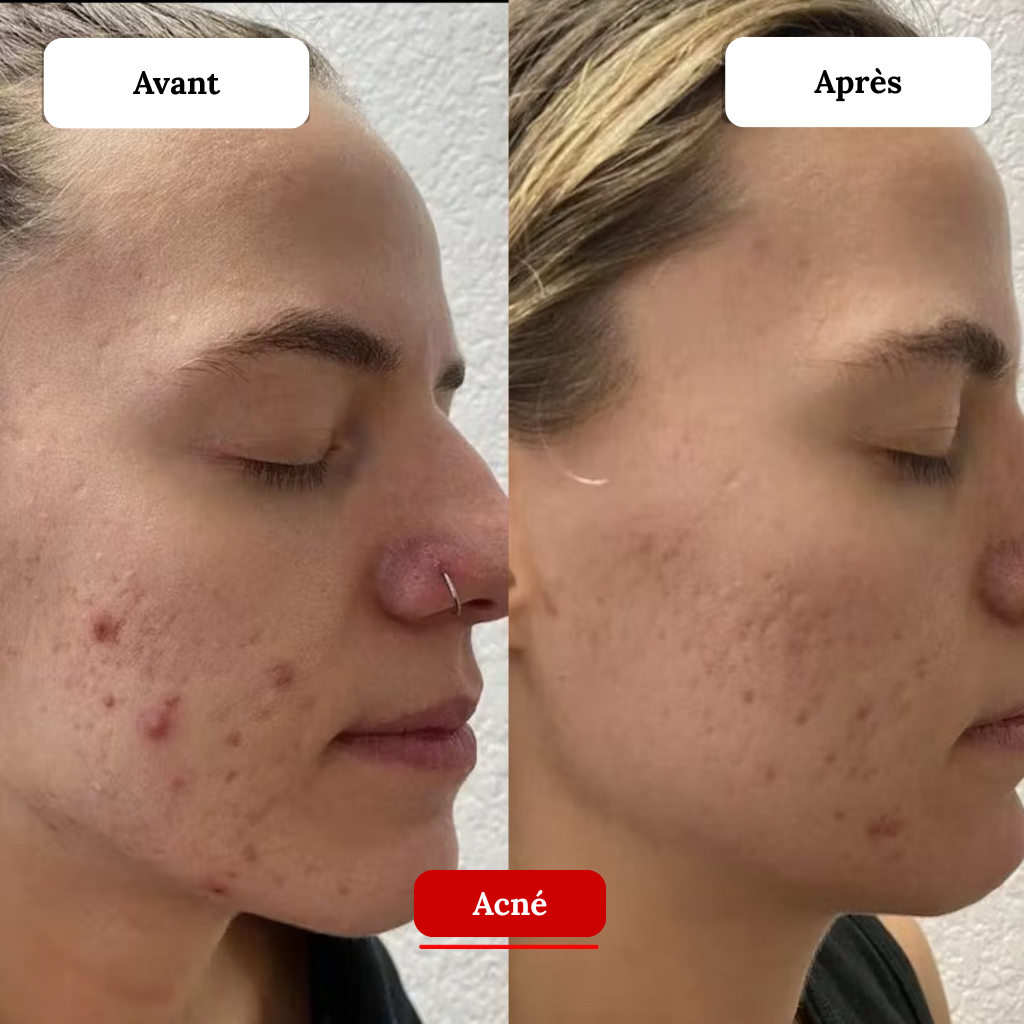 Luminova - Masque LED 7 Couleurs